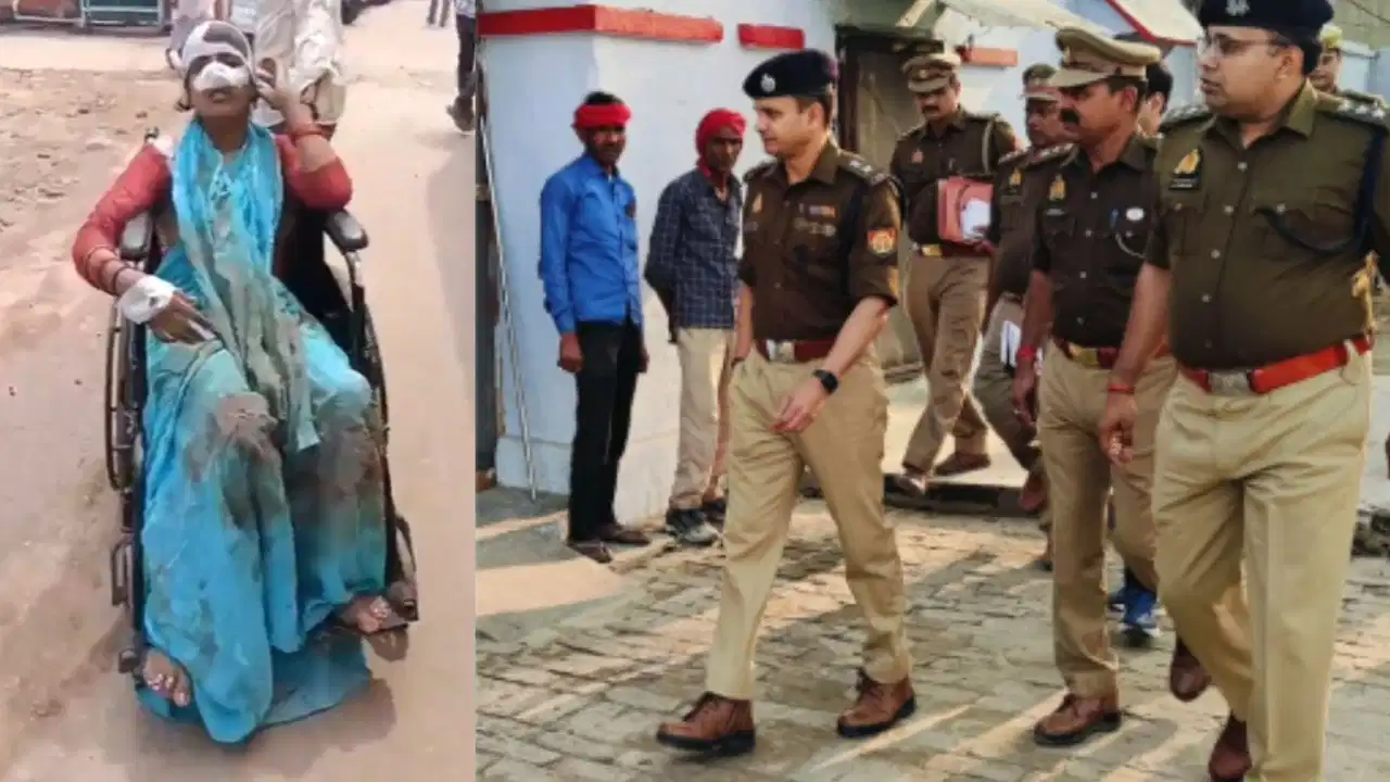 हरदोई में पत्नी का आरोप- पति ने काटी नाक, हसबैंड बोला- उसने ही मुझे मारा; 6 महीने पहले हुई थी शादी