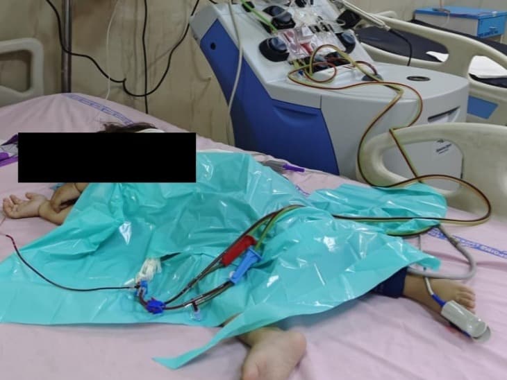 लखनऊ में ढाई साल की बच्ची का 5 गुना ज्यादा बढ़ गया था कोलेस्ट्रॉल, डॉक्टरों ने प्लाज्मा एक्सचेंज कर बचाई जान